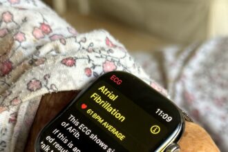 Apple Watch Series 10 ECG detects irregular heartbeat